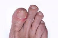Chesterfield Podiatry image 3